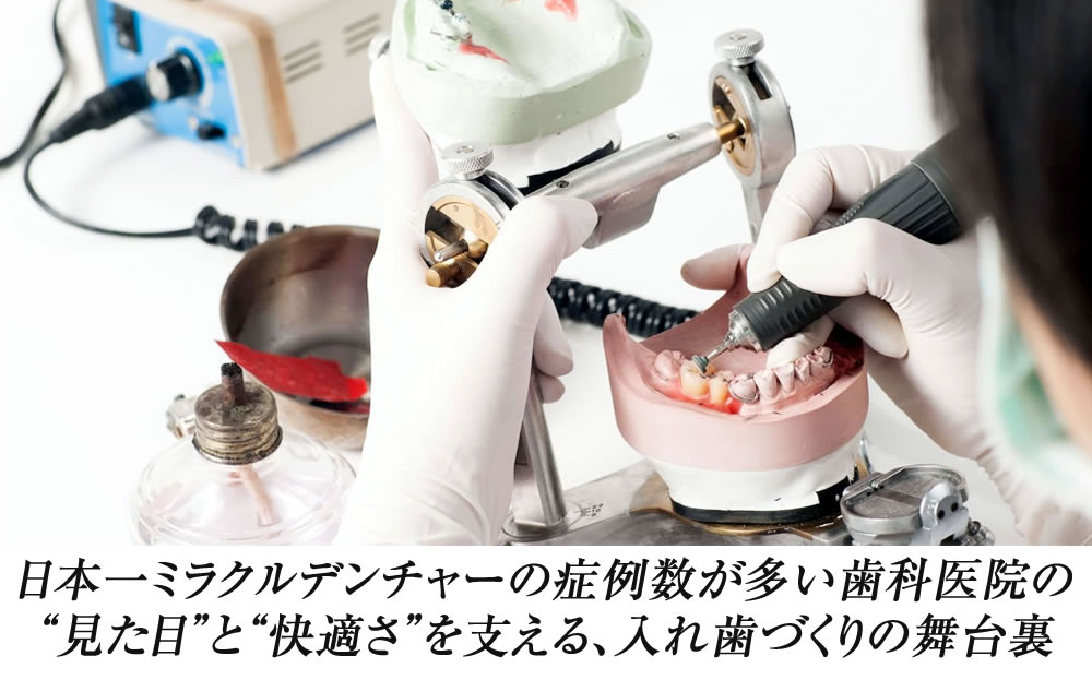 院長 × ミラクルデンチャー技工士 対談